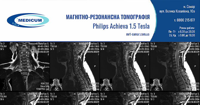 Розшифрування результатів МРТ: що ви отримаєте після обстеження